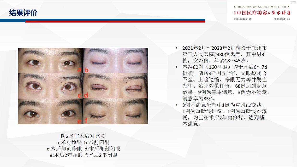 无需3.png 无需3.png